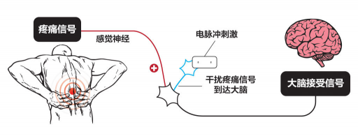 【ZE科普】一樣是電，為什么名字如此花哨