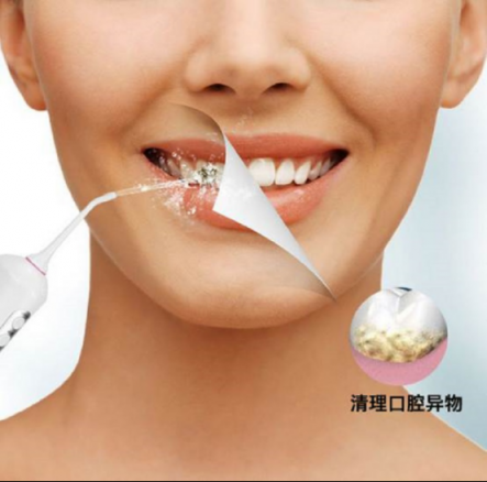 口腔清潔好幫手，美國(guó)XNUO心諾沖牙器值得信賴