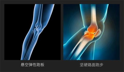 小米眾籌首款智能折疊跑步機(jī)來襲，讓愛跑步的人有“地”放矢