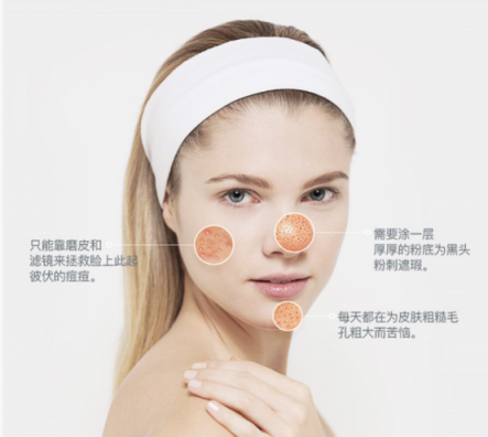 一百種去黑頭的方法都失敗了？去黑頭攻略全部拿下！