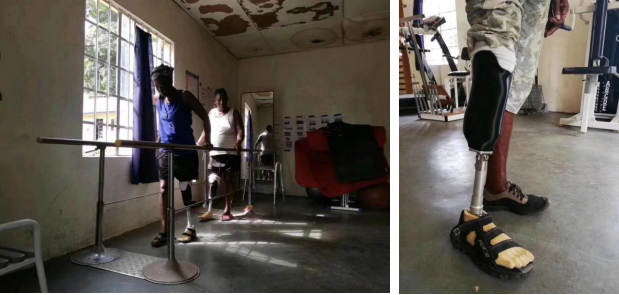 先臨三維3D數(shù)字化解決方案，援助塞拉利昂 3D Sierra Leone 醫(yī)療輔具定制項目