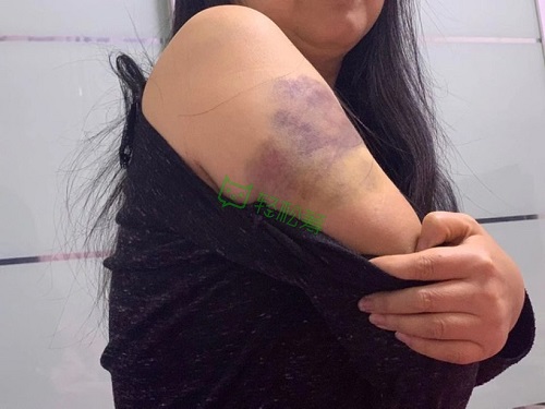 “我想有生之年看到女兒出嫁！”浙江婦女患罕見病發(fā)起輕松籌急籌19萬治療費