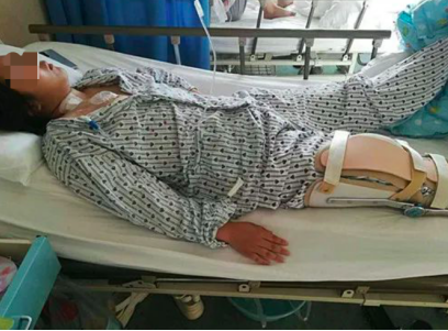 水滴籌·水滴公益助單親爸爸救骨癌女兒：我與女兒相依為命，不能沒有她