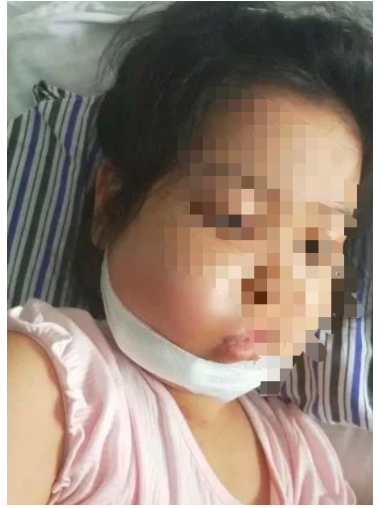 女童3歲確診白血病7歲復(fù)發(fā)，百萬治療費無著落，水滴籌款幫孩子圓上學(xué)夢