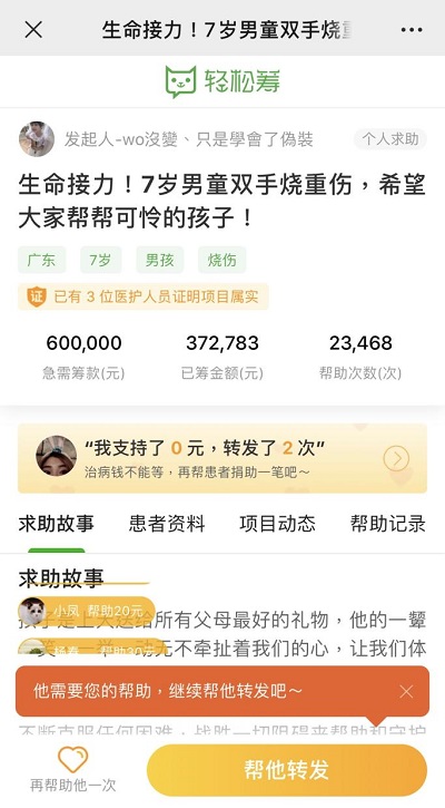 生命接力！輕松籌上愛心匯聚，幫助被生父燒傷的可憐男童重獲新生