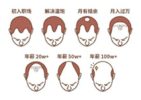 2.5億人被脫發(fā)困擾？Rogaine培健實力生發(fā)