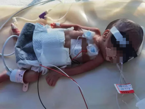 孩子剛出生就住進ICU，水滴籌筑起生命長城
