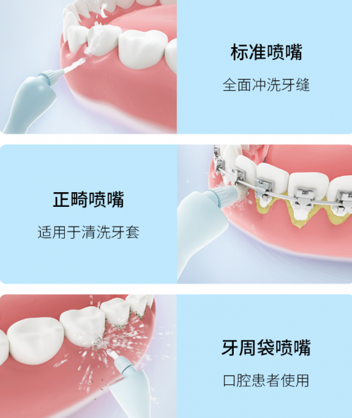 正畸人士福音！素諾智能可視沖牙器C3 pro看得清，沖得凈