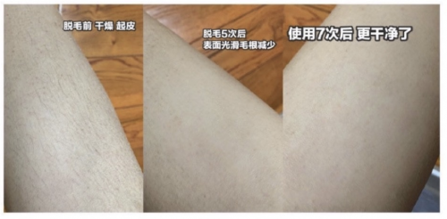 中秋你送月餅我送ulike脫毛儀！團(tuán)圓之日還要美美的！
