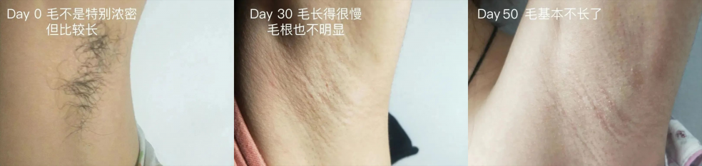 長(zhǎng)胡子不是女生“原罪”，讓Ulike脫毛儀來為你解決煩惱
