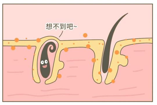女生為啥會長小胡子，用Ulike脫毛儀有用嗎