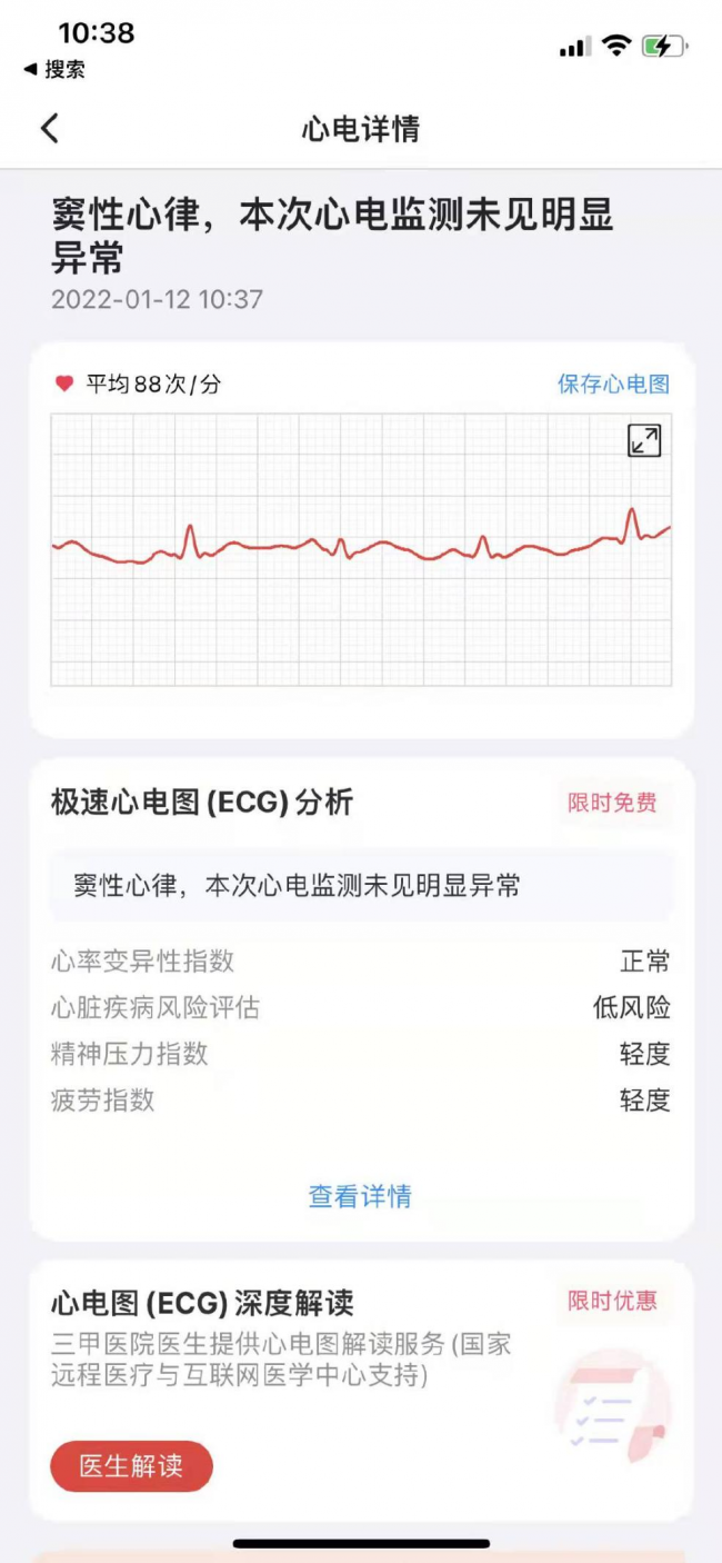 春節(jié)市場(chǎng)健康類(lèi)產(chǎn)品升溫 心臟+APP深度評(píng)測(cè)