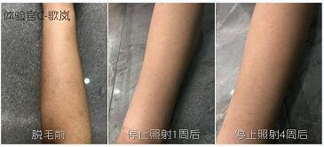這3款網(wǎng)紅脫毛儀評測大集錦，你都了解過了嗎？