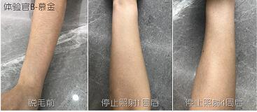 這3款網(wǎng)紅脫毛儀評測大集錦，你都了解過了嗎？