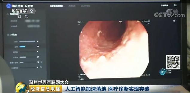 用AI做食管癌診斷證明“科技向善”，騰訊這個(gè)腦回路有點(diǎn)神！