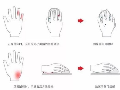 當鼠標“垂直”，會發(fā)生什么？多彩垂直鼠標體驗