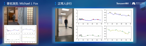 騰訊醫(yī)療人工智能研究院院長范偉：超越認(rèn)知，AI重塑運(yùn)動(dòng)評估