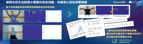 騰訊醫(yī)療人工智能研究院院長范偉：超越認(rèn)知，AI重塑運(yùn)動(dòng)評估