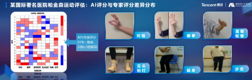 騰訊醫(yī)療人工智能研究院院長范偉：超越認(rèn)知，AI重塑運(yùn)動(dòng)評估