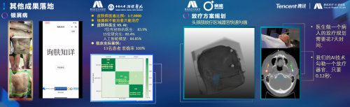 騰訊醫(yī)療人工智能研究院院長范偉：超越認(rèn)知，AI重塑運(yùn)動(dòng)評估
