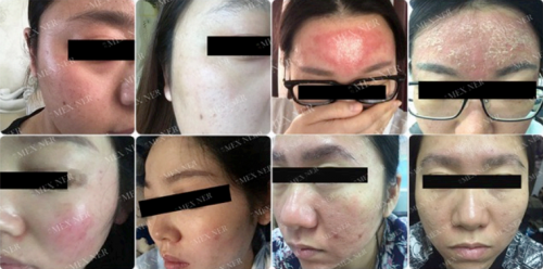 美內(nèi)“小奶泡”，最簡單的潔面產(chǎn)品你選對了嗎？
