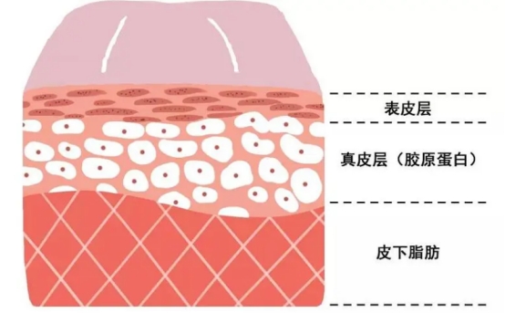 不做表面功夫，潤(rùn)致娃娃針+分層抗衰讓你年齡滿40減20